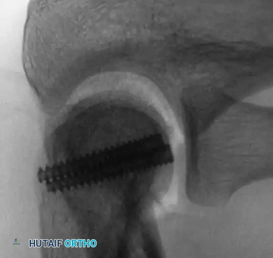 Hutaifortho's Orthopaedic Diagram