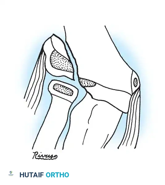 Hutaifortho's Orthopaedic Diagram