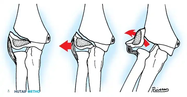Hutaifortho's Orthopaedic Diagram