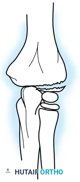 Hutaifortho's Orthopaedic Diagram