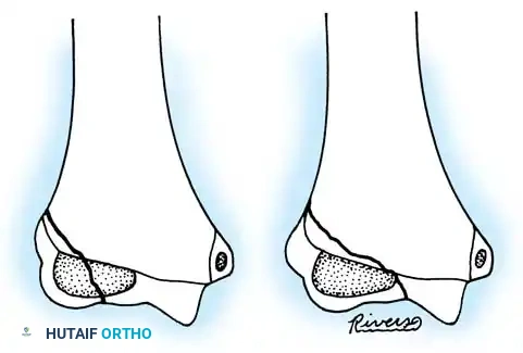 Operative Orthopaedics Clinical Reference