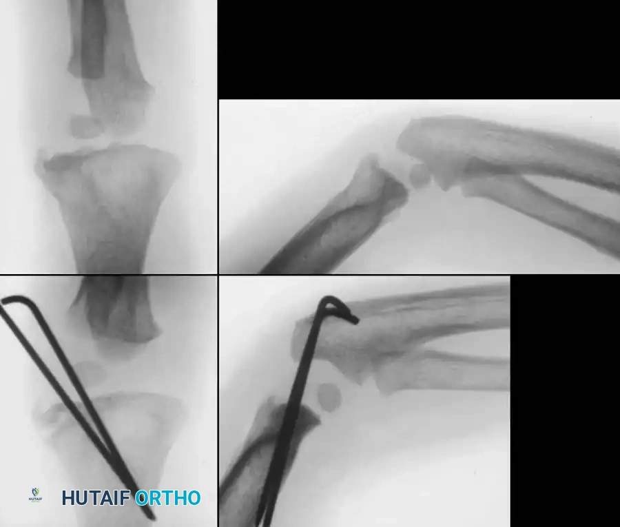 Hutaifortho's Orthopaedic Diagram