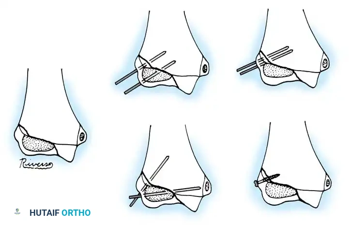 Hutaifortho's Orthopaedic Diagram