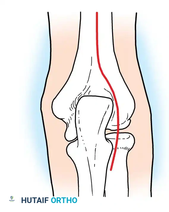 Hutaifortho's Orthopaedic Diagram
