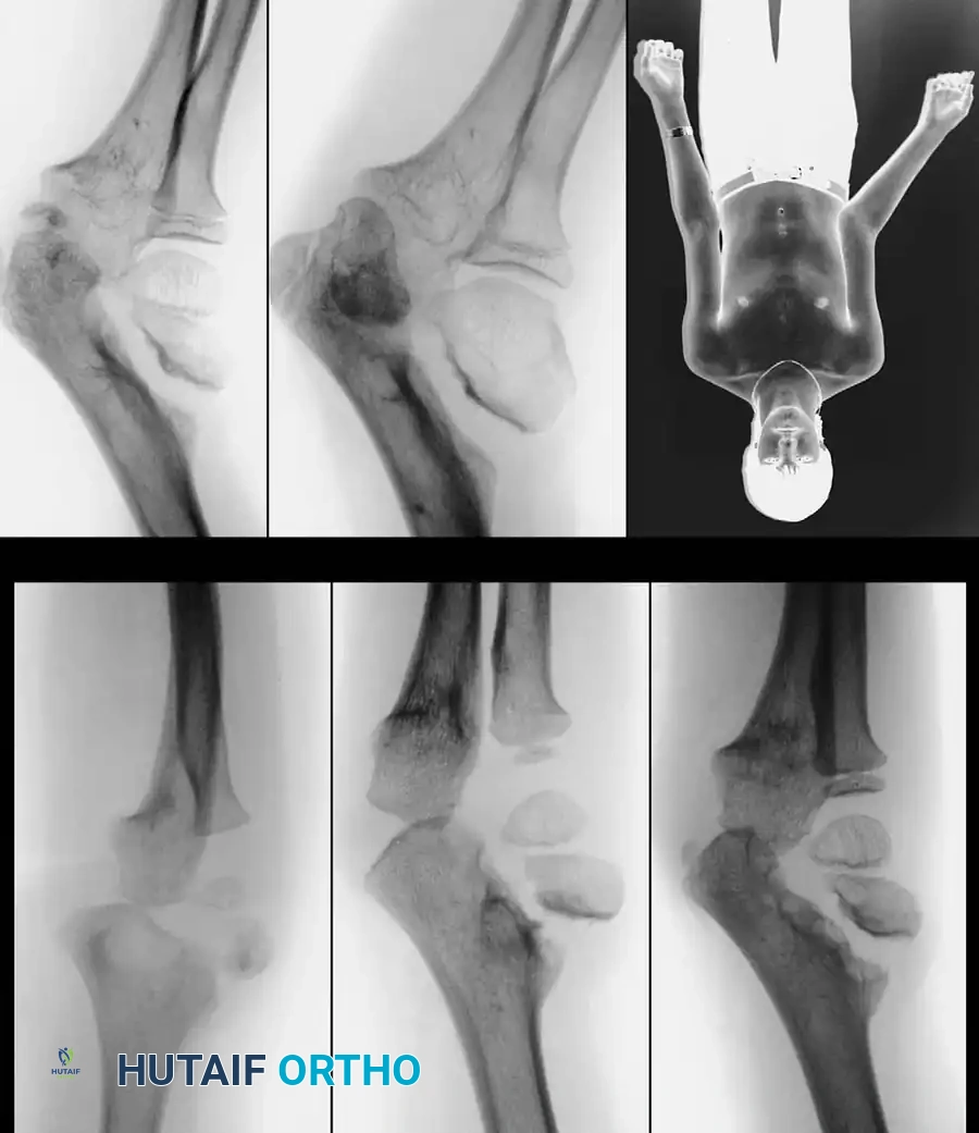 Hutaifortho's Orthopaedic Diagram