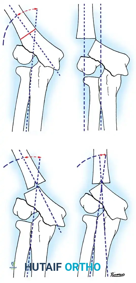 Hutaifortho's Orthopaedic Diagram
