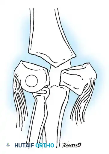 Hutaifortho's Orthopaedic Diagram