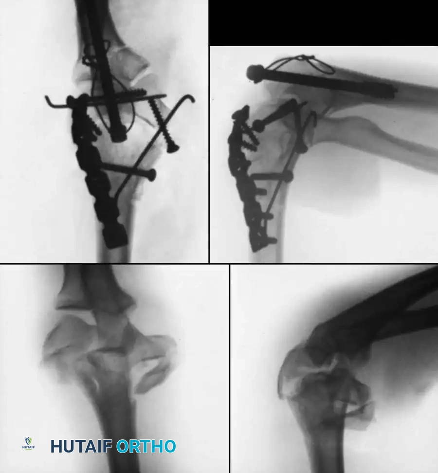 Hutaifortho's Orthopaedic Diagram