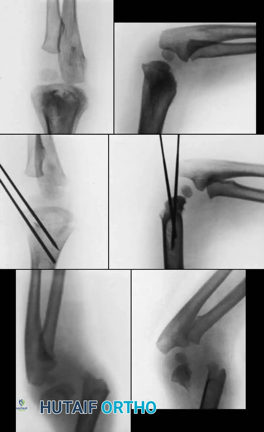 Hutaifortho's Orthopaedic Diagram