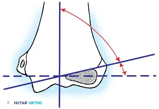 Operative Orthopaedics Clinical Reference