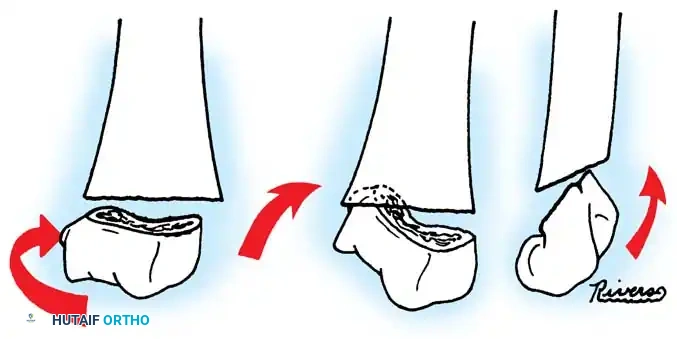 Hutaifortho's Orthopaedic Diagram
