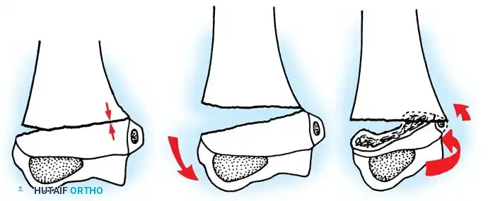 Hutaifortho's Orthopaedic Diagram