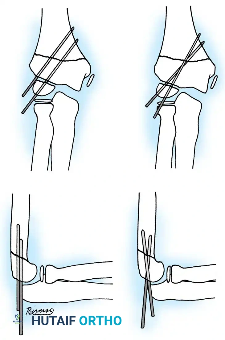 Hutaifortho's Orthopaedic Diagram