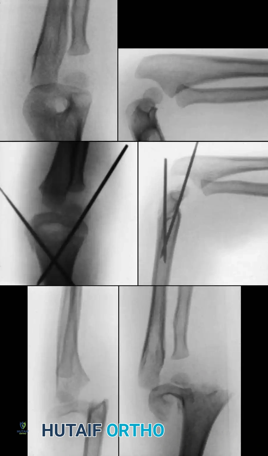 Hutaifortho's Orthopaedic Diagram