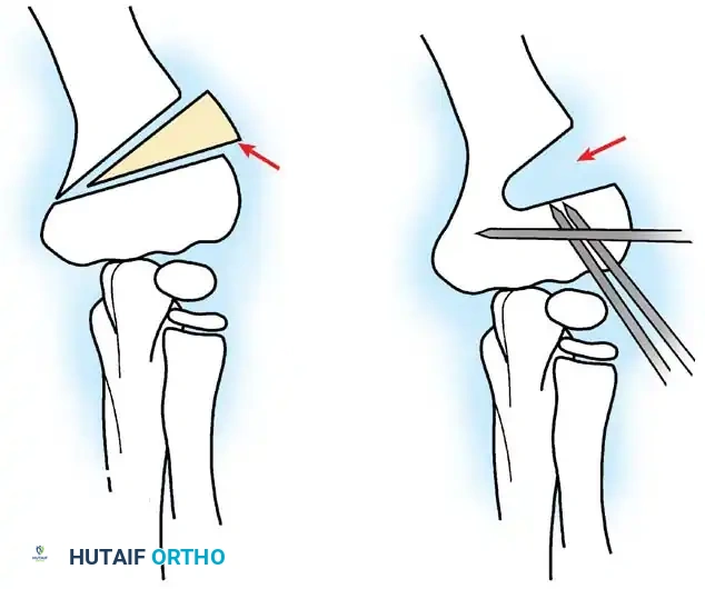 Hutaifortho's Orthopaedic Diagram