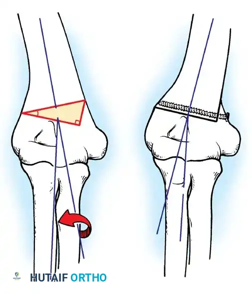 Hutaifortho's Orthopaedic Diagram