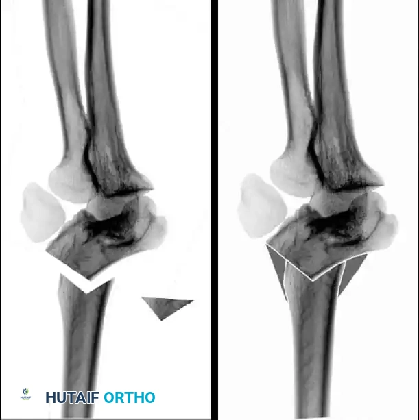 Hutaifortho's Orthopaedic Diagram