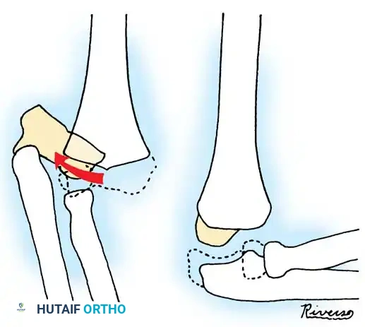 Operative Orthopaedics Clinical Reference