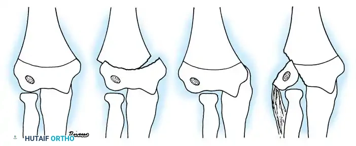 Hutaifortho's Orthopaedic Diagram