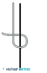 ELBOW Surgical Diagram