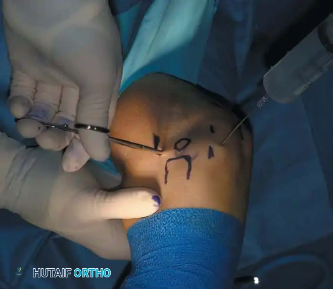 Surgeon operating in prone position