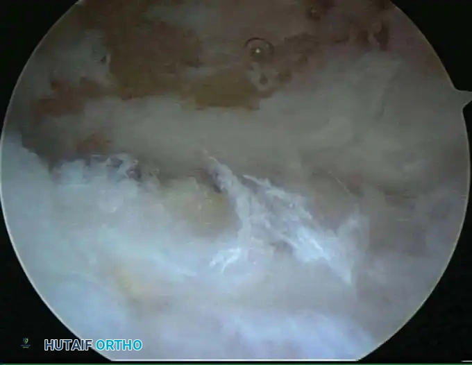 Prone positioning clinical view