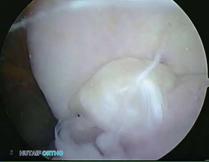 Fluid management system