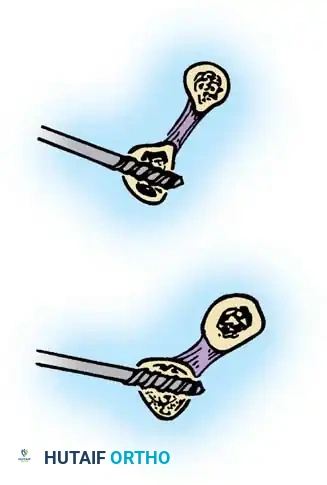 Hutaifortho's Orthopaedic Diagram