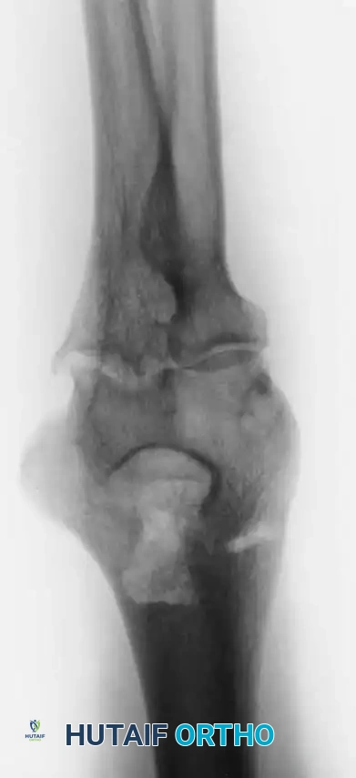 Hutaifortho's Orthopaedic Diagram