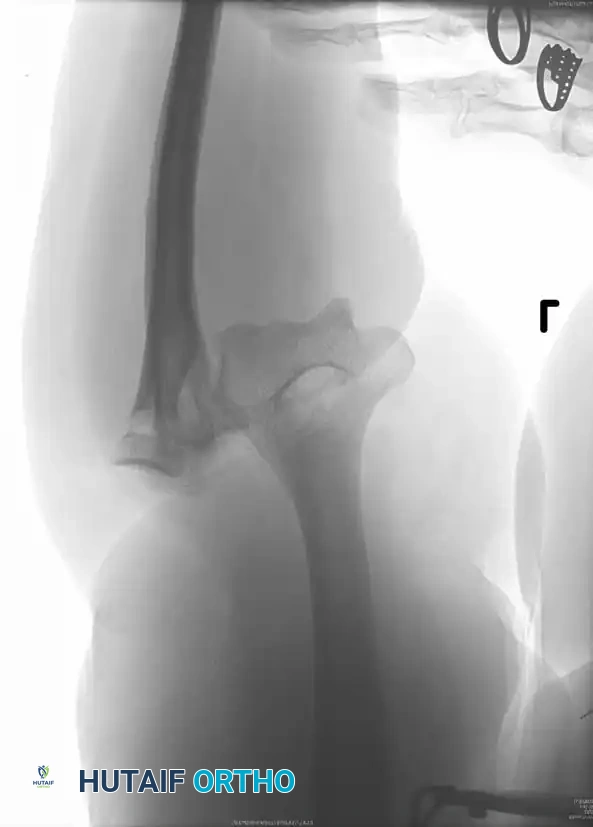 Hutaifortho's Orthopaedic Diagram