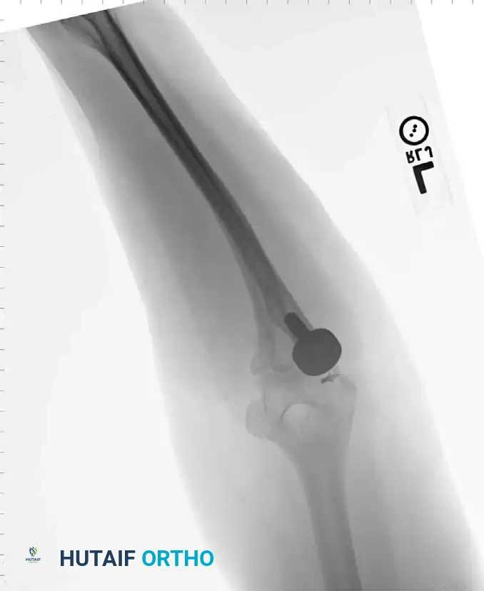 Hutaifortho's Orthopaedic Diagram