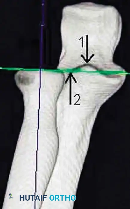 Hutaifortho's Orthopaedic Diagram