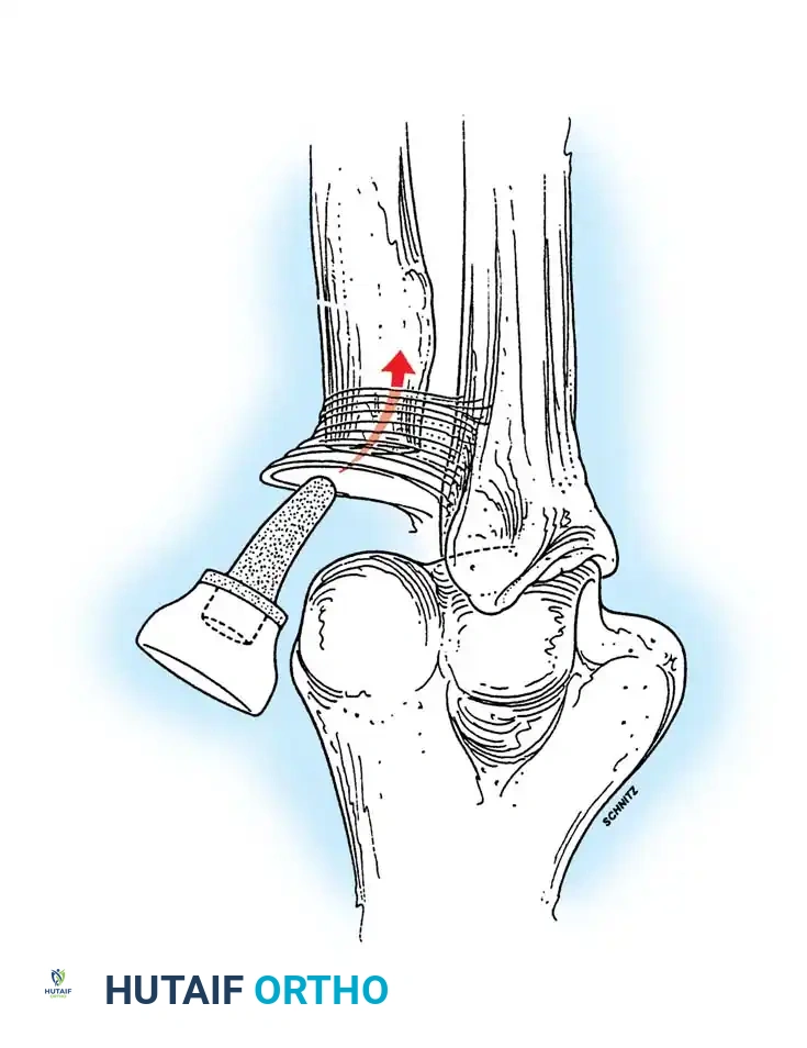 Hutaifortho's Orthopaedic Diagram