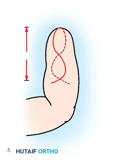 Hutaifortho's Orthopaedic Diagram