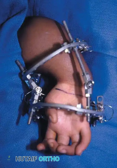 Hutaifortho's Orthopaedic Diagram