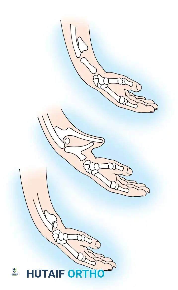 Hutaifortho's Orthopaedic Diagram