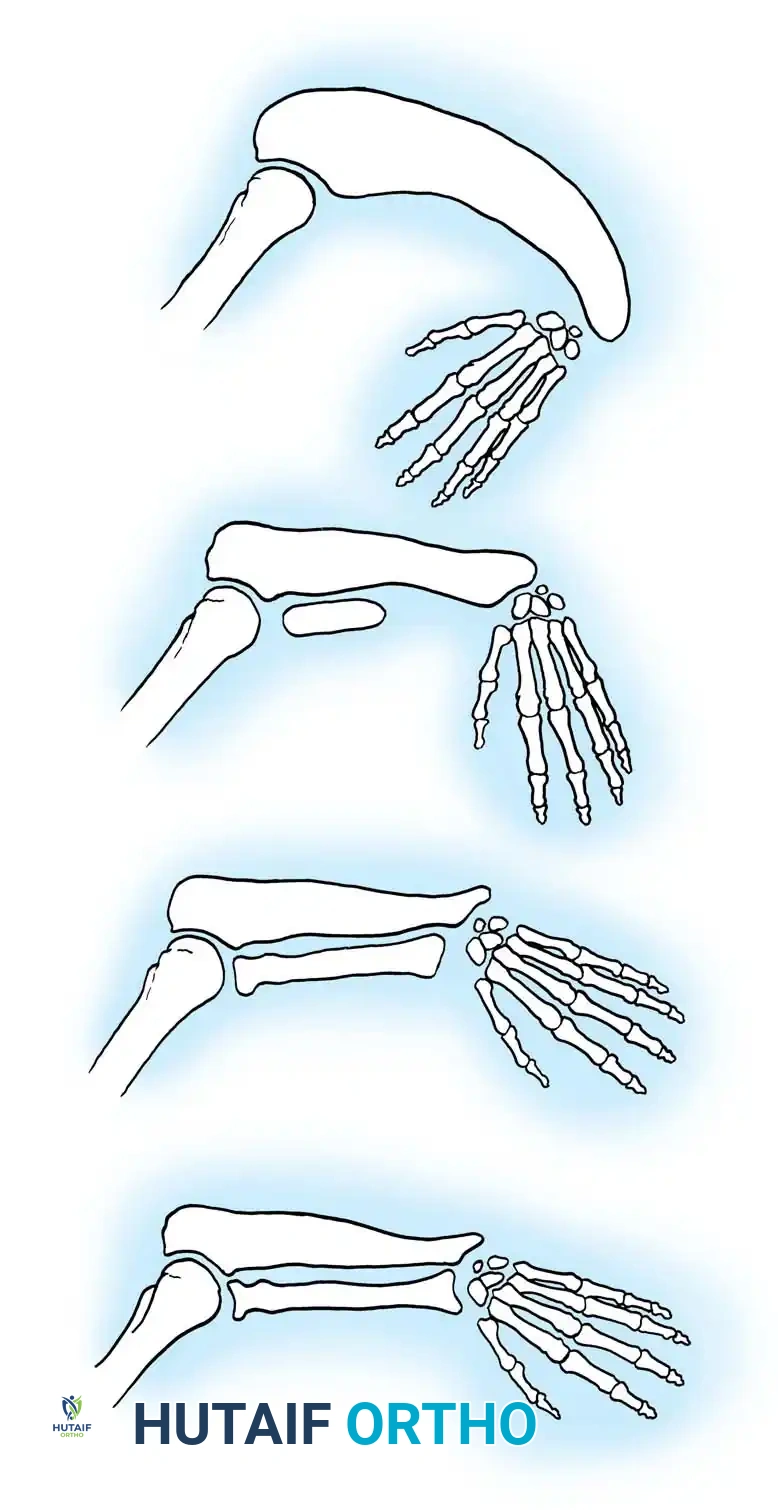 Hutaifortho's Orthopaedic Diagram