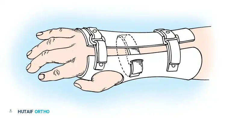 Hutaifortho's Orthopaedic Diagram
