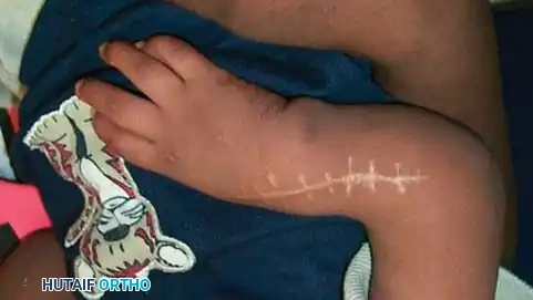 Hutaifortho's Orthopaedic Diagram