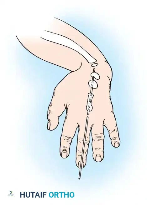 Hutaifortho's Orthopaedic Diagram