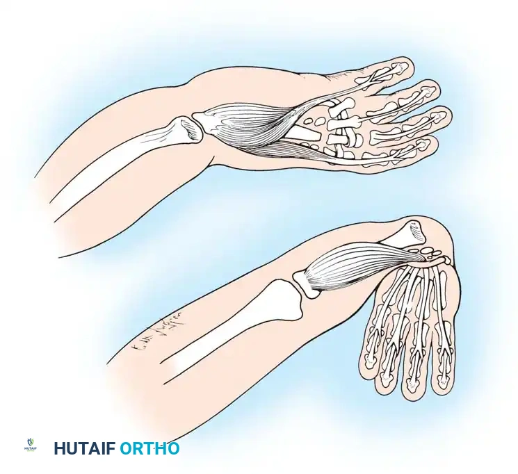 Hutaifortho's Orthopaedic Diagram