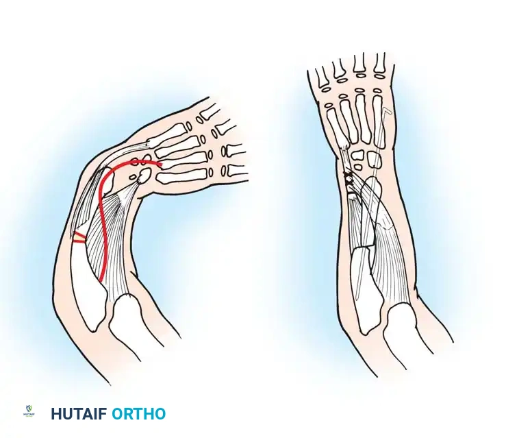 Hutaifortho's Orthopaedic Diagram