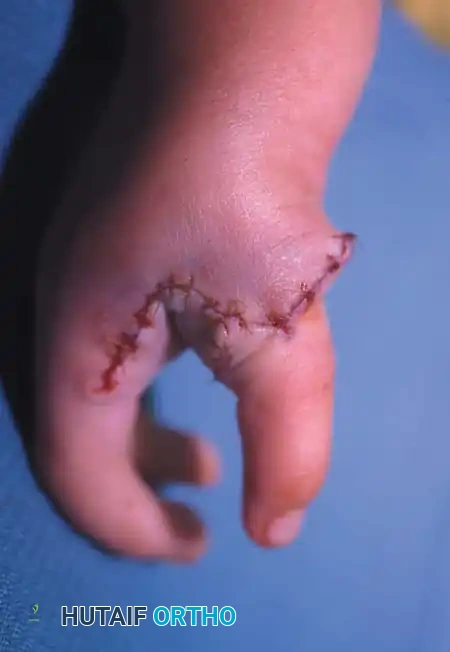 Hutaifortho's Orthopaedic Diagram