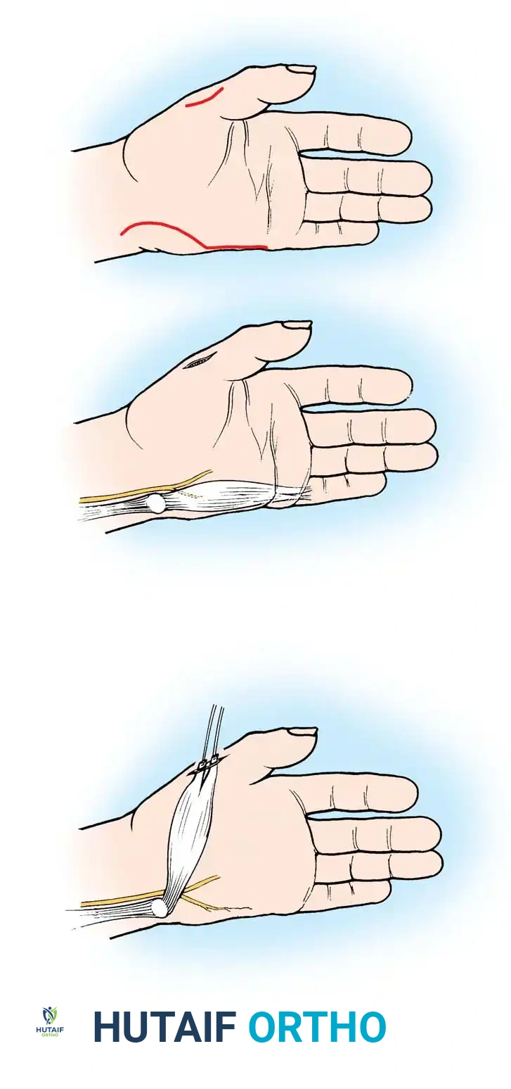 Hutaifortho's Orthopaedic Diagram