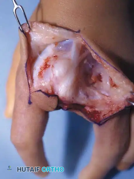 Hutaifortho's Orthopaedic Diagram