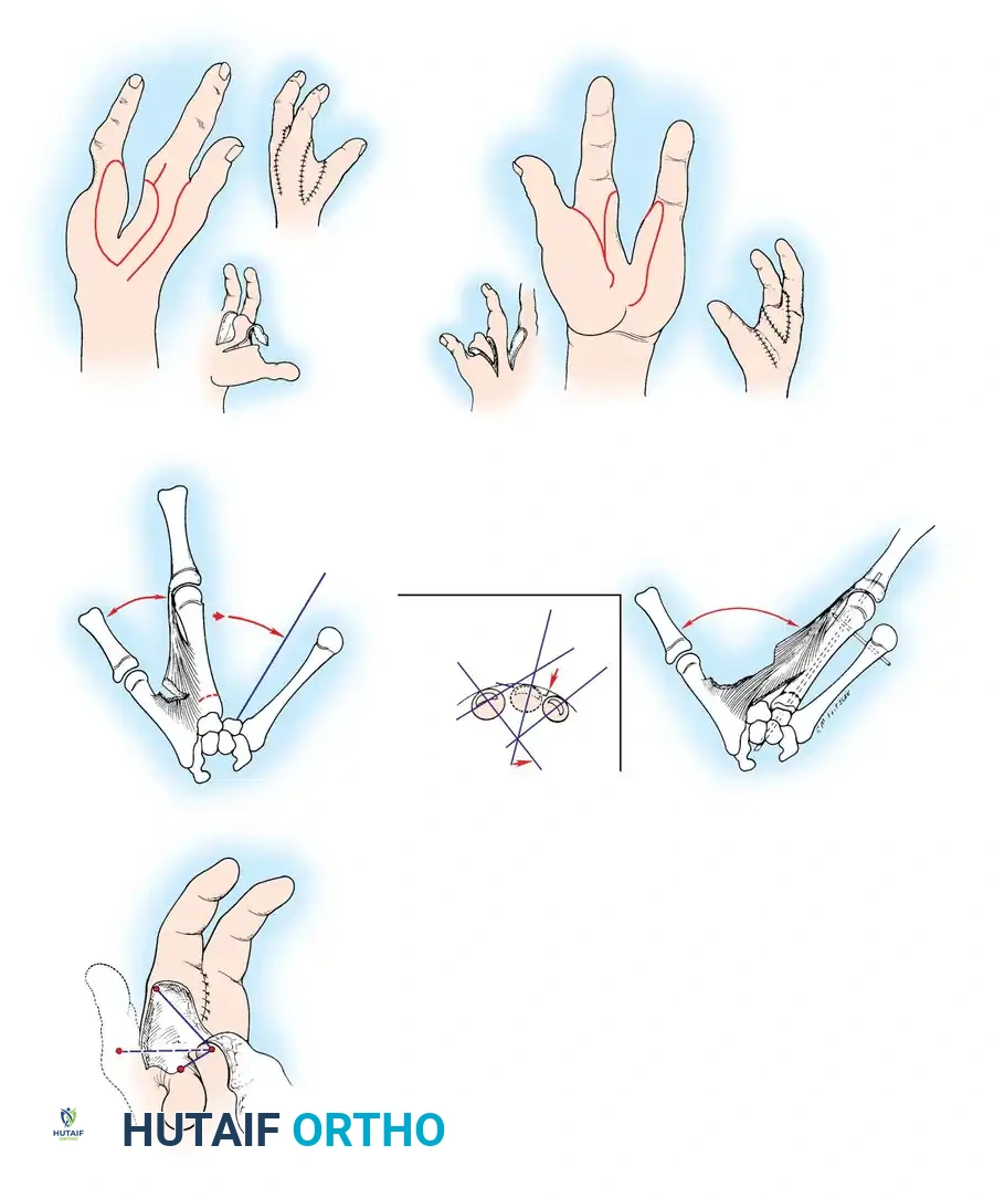 Hutaifortho's Orthopaedic Diagram