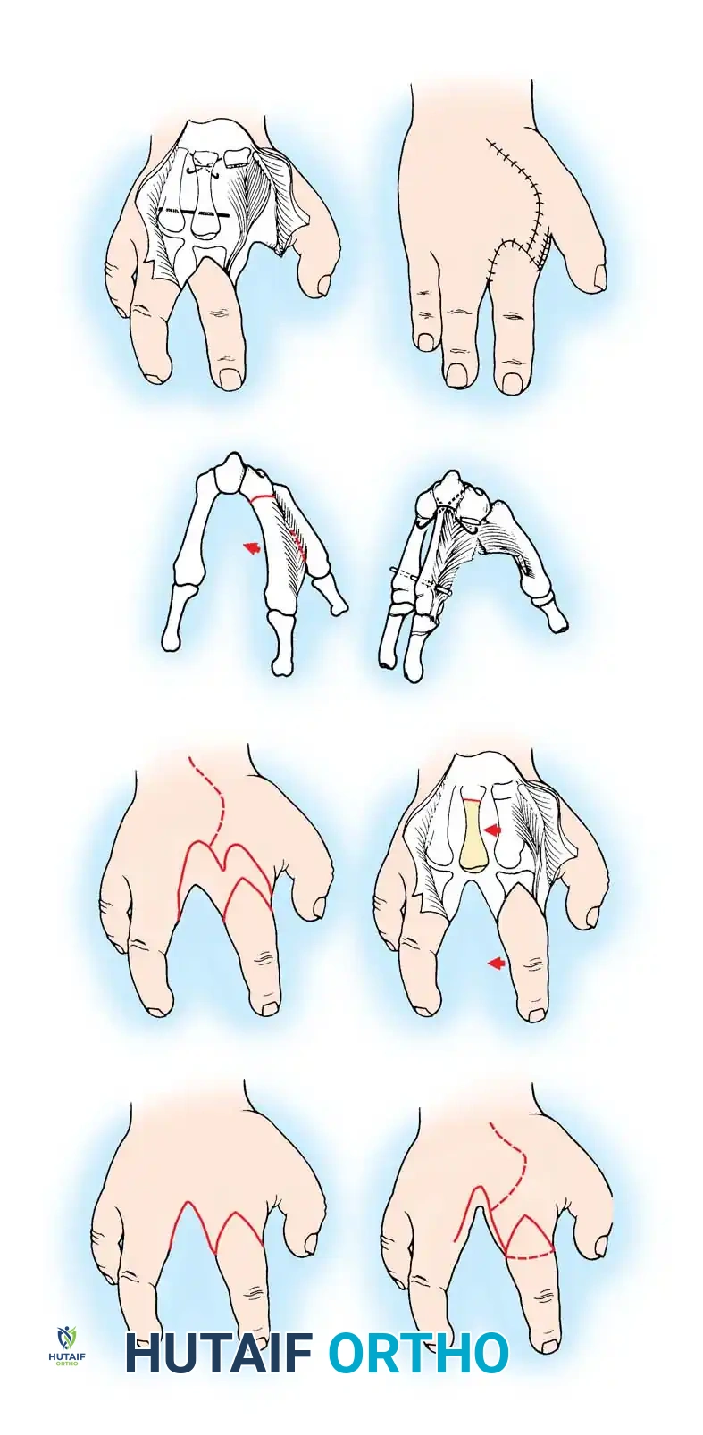 Hutaifortho's Orthopaedic Diagram