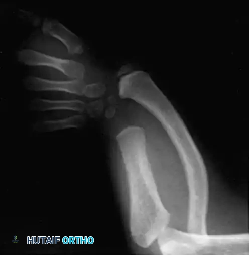 Hutaifortho's Orthopaedic Diagram