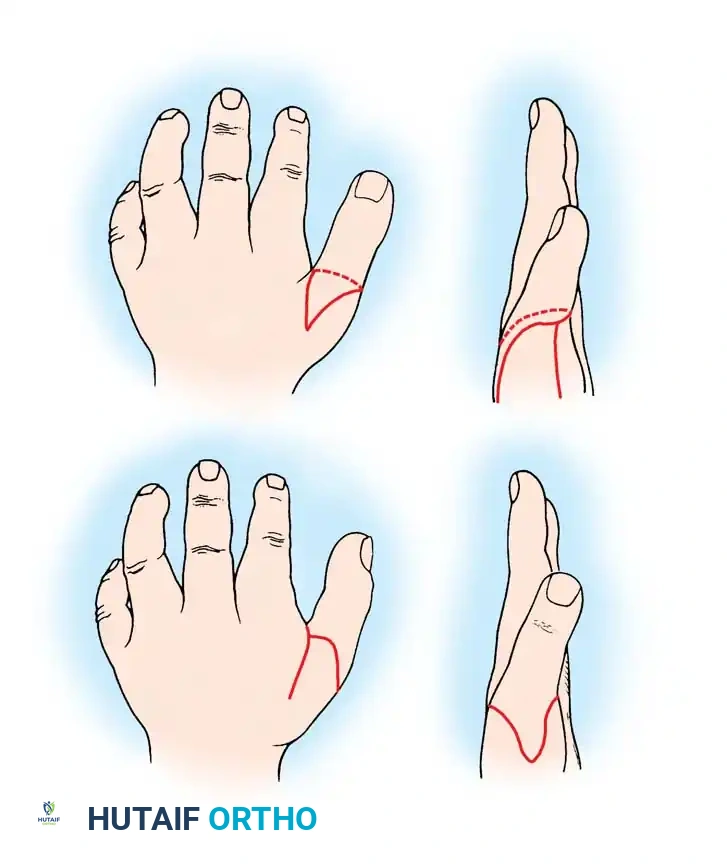 Hutaifortho's Orthopaedic Diagram