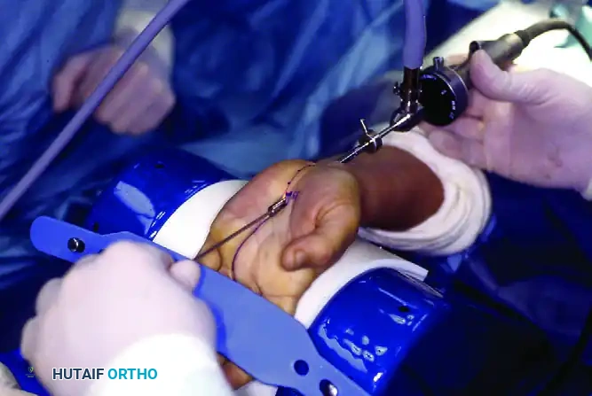 Intraoperative Setup